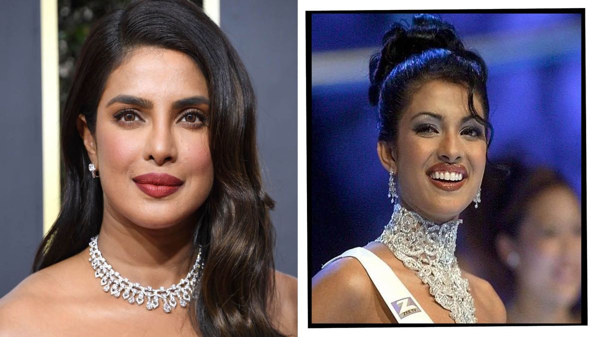 Priyanka Chopra writes about her ‘unfinished nose surgery’ that left her devastated