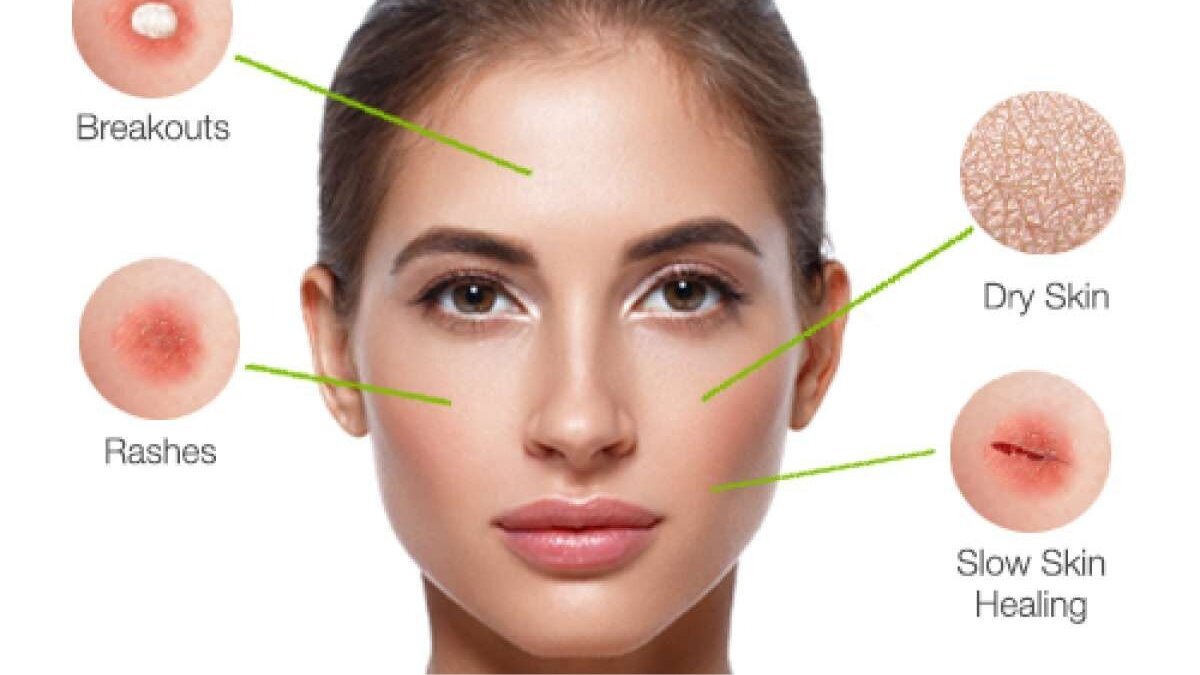 5 signs shows that your skin is stressed