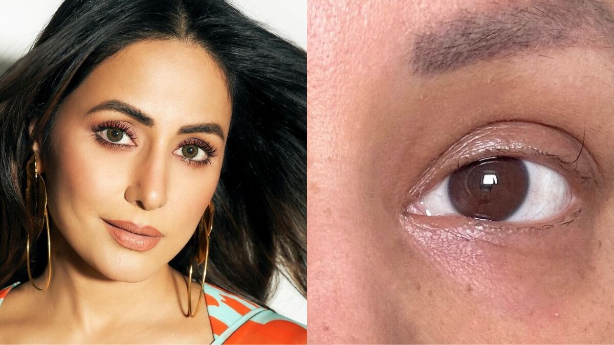 Hina Khan Calls Her ‘Last Standing Eyelash’ a Symbol of Strength