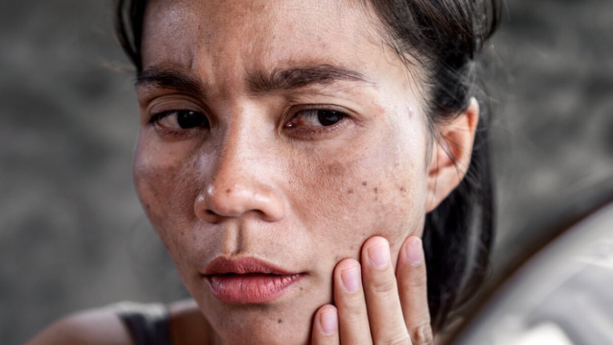 The Silent Threat: How UV Rays Are Damaging Your Skin Every Day