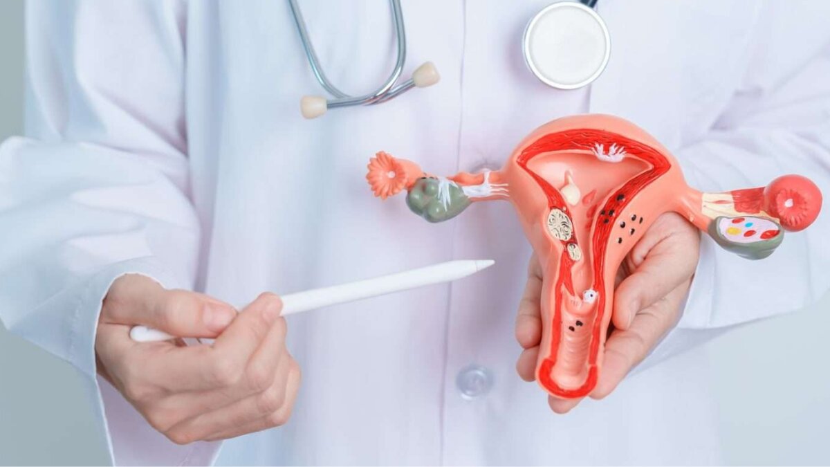 PCOS Warning Signs: 5 Symptoms You Shouldn’t Ignore