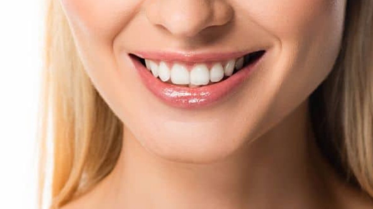 Say goodbye to cavities: how they form, how to prevent them and best eays to treat tooth decay