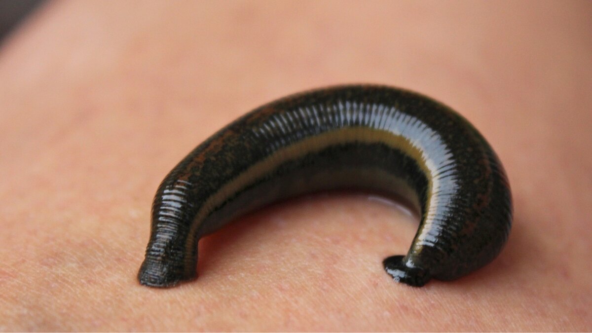 How to treat leech bite safely at home: Step-by-step care, do’s and don’ts