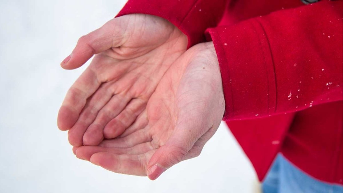 5 Effective ways to treat frostbite safely at home